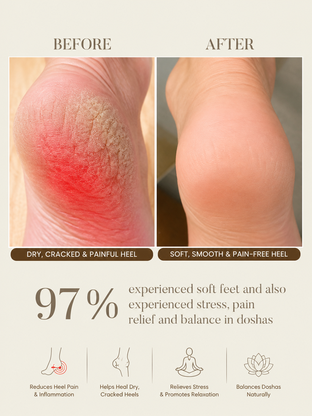 Before and after comparison of a heel with dry, cracked, and painful skin versus soft, smooth, and pain-free skin, with text highlighting benefits and statistics.
